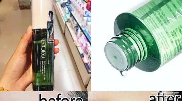 Khả năng trị mụn của Naruko Tea Tree Toner rất tốt (Nguồn: Internet) Review nước hoa hồng trị mụn Naruko Tea Tree Shine Control and Blemish Clear Toner - BlogAnChoi