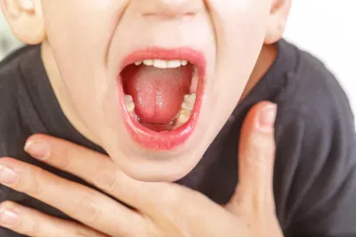 viêm họng hạt