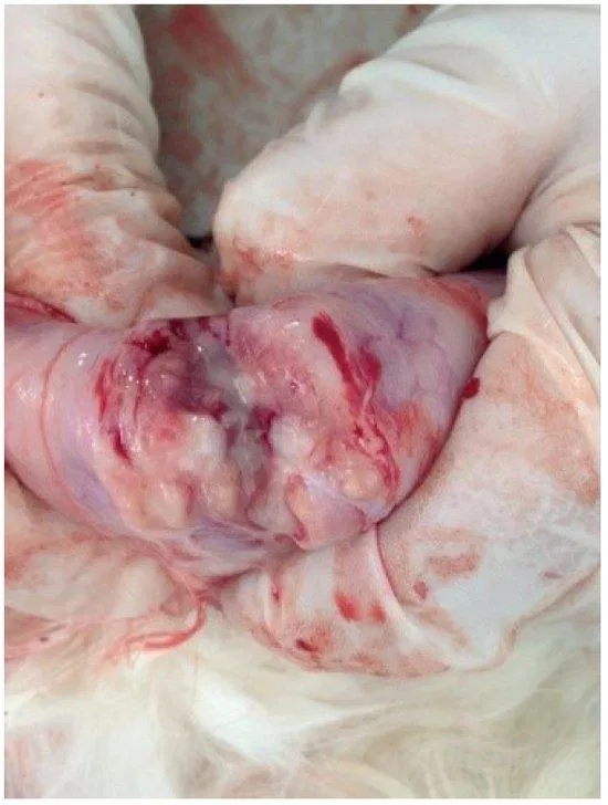 tổn thương nội tạng