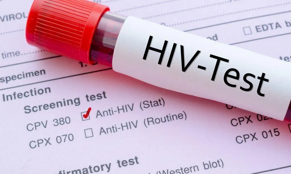 hiv test