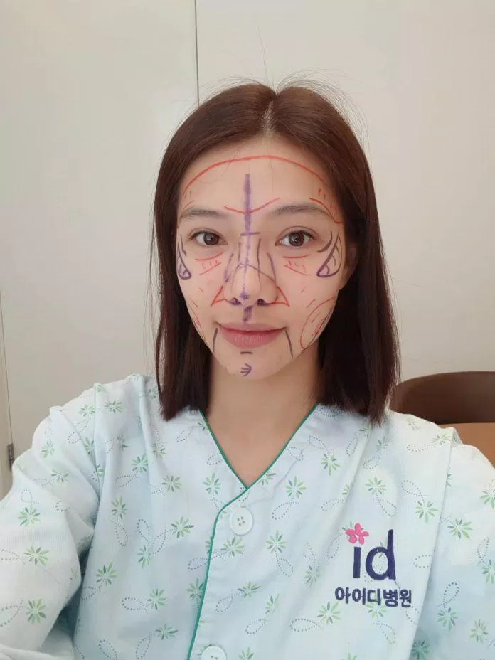 lưu đê ly