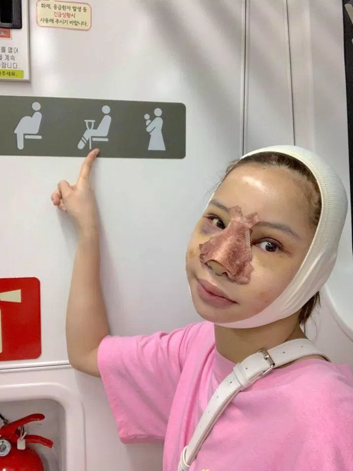 lưu đê ly