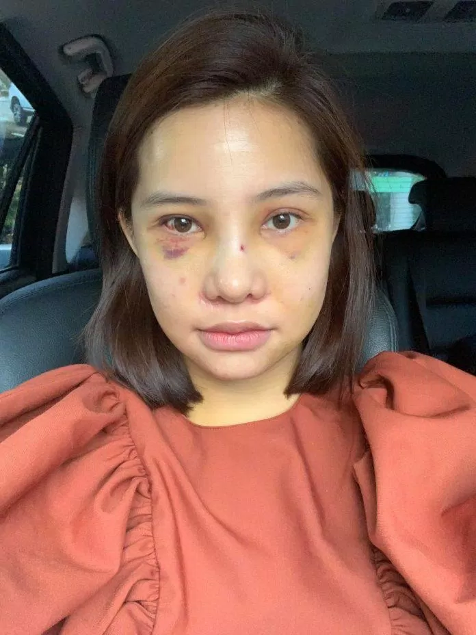 lưu đê ly