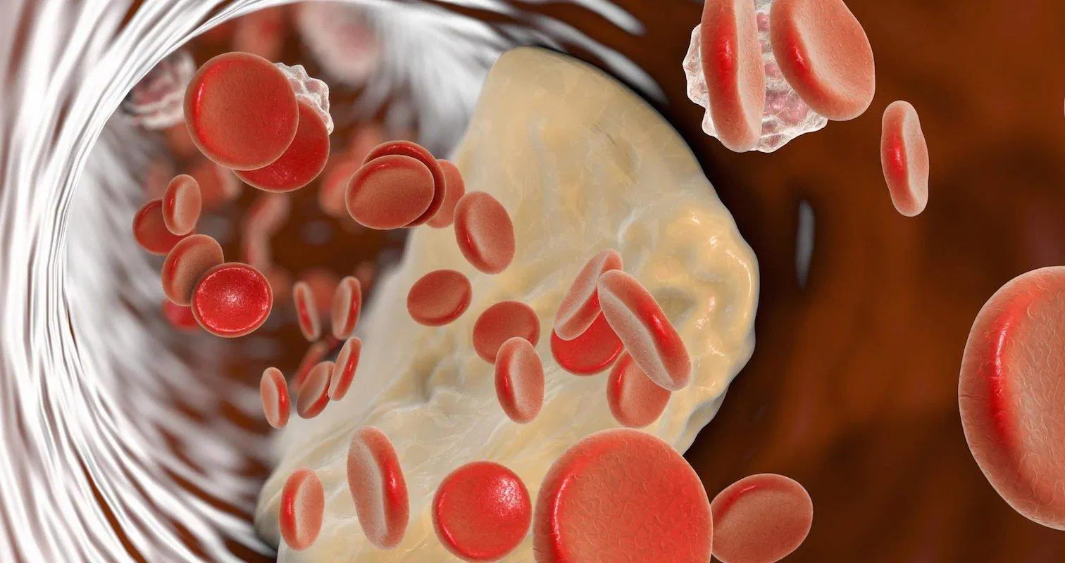 Giảm cholesterol bằng việc ăn đậu bắp