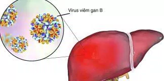 Bệnh viêm gan B