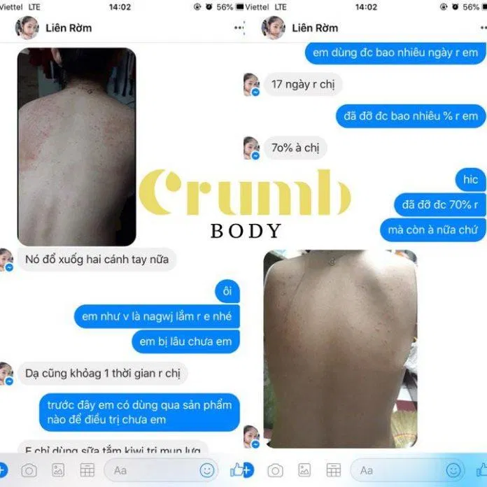 Đánh giá khách hàng về sản phẩm trị mụn lưng Crum Body. (Nguồn: Internet)