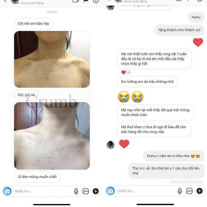 Đánh giá khách hàng về sản phẩm trị mụn lưng Crum Body. (Nguồn: Internet)