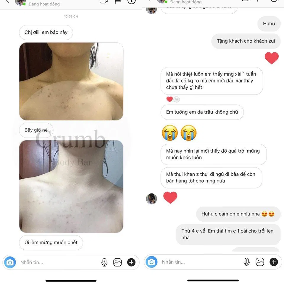 Đánh giá khách hàng về sản phẩm trị mụn lưng Crum Body. (Nguồn: Internet)