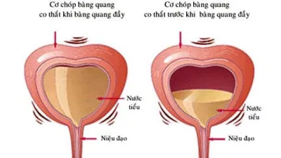 bàng quang