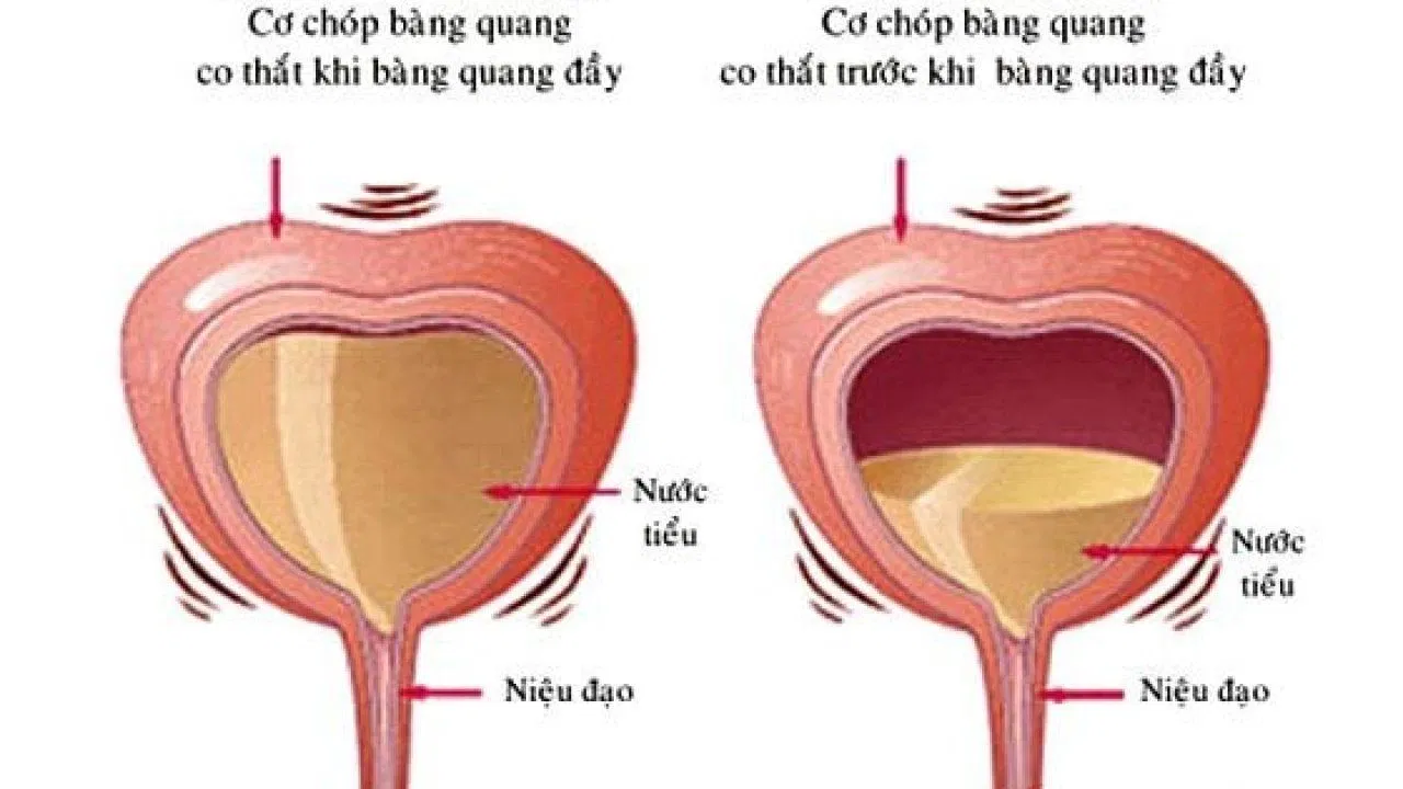 bàng quang