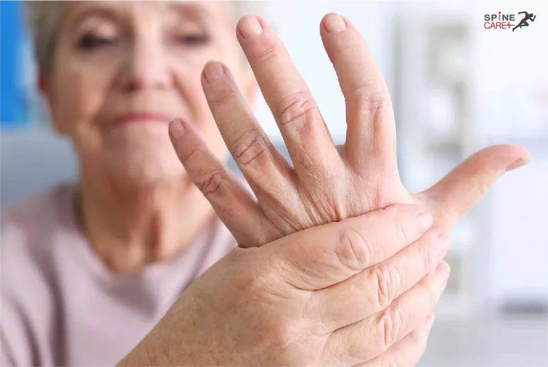 viêm khớp dạng thấp