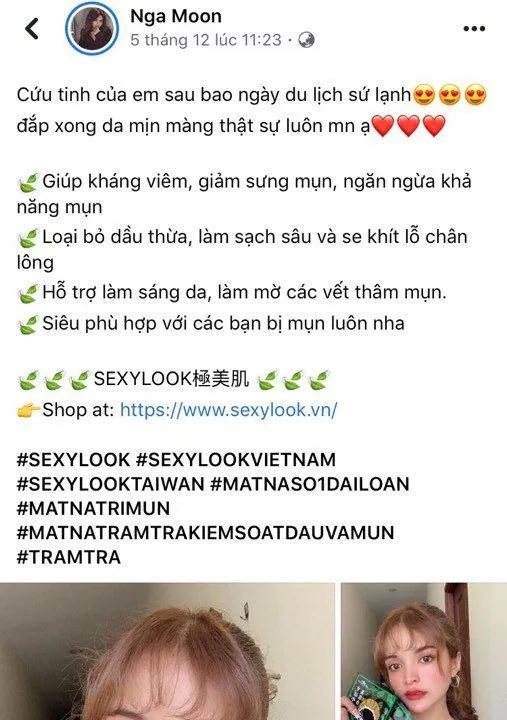 Cô nàng Nga Moon coi mặt nạ tràm trà nhà SEXYLOOK như một cứu tinh đối với làn da của mình (nguồn: Internet).