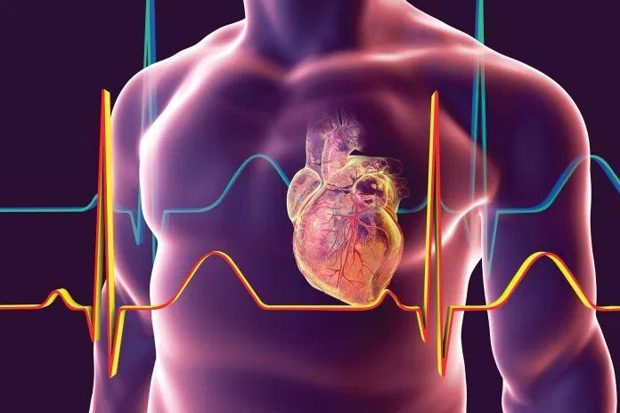 Tai biến mạch máu não