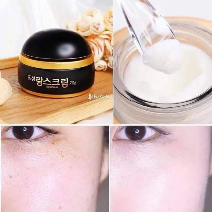 Chất kem mịn màng như bơ với khả năng trị nám hiệu quả Chất kem mịn màng như bơ với khả năng trị nám hiệu quả (Ảnh: Internet)