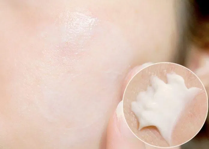 Kem trị nám Transino chứa các thành phần đặc trị nám, viêm nhiễm trên da Kem trị nám Transino chứa các thành phần đặc trị nám, viêm nhiễm trên da (Ảnh: Internet)