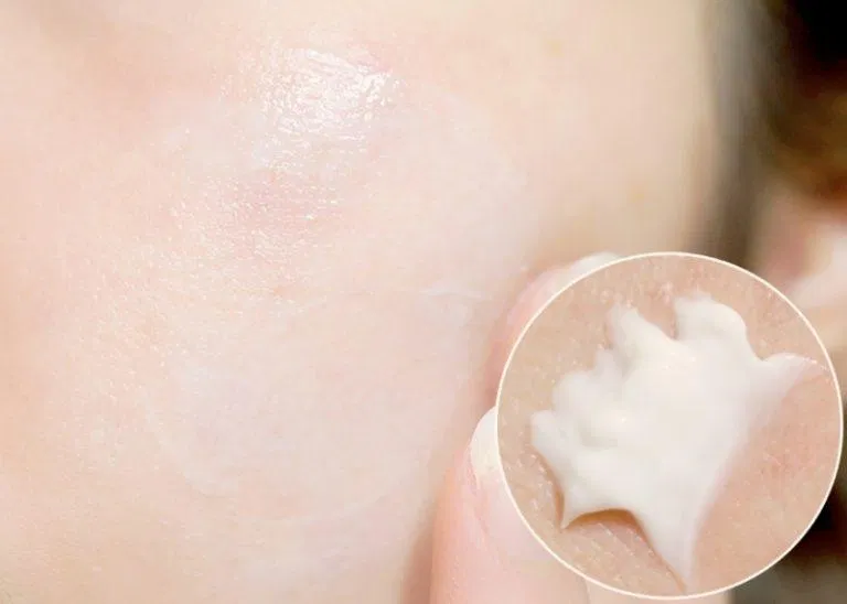 Kem trị nám Transino chứa các thành phần đặc trị nám, viêm nhiễm trên da Kem trị nám Transino chứa các thành phần đặc trị nám, viêm nhiễm trên da (Ảnh: Internet)