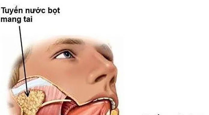 tuyến nước bọt