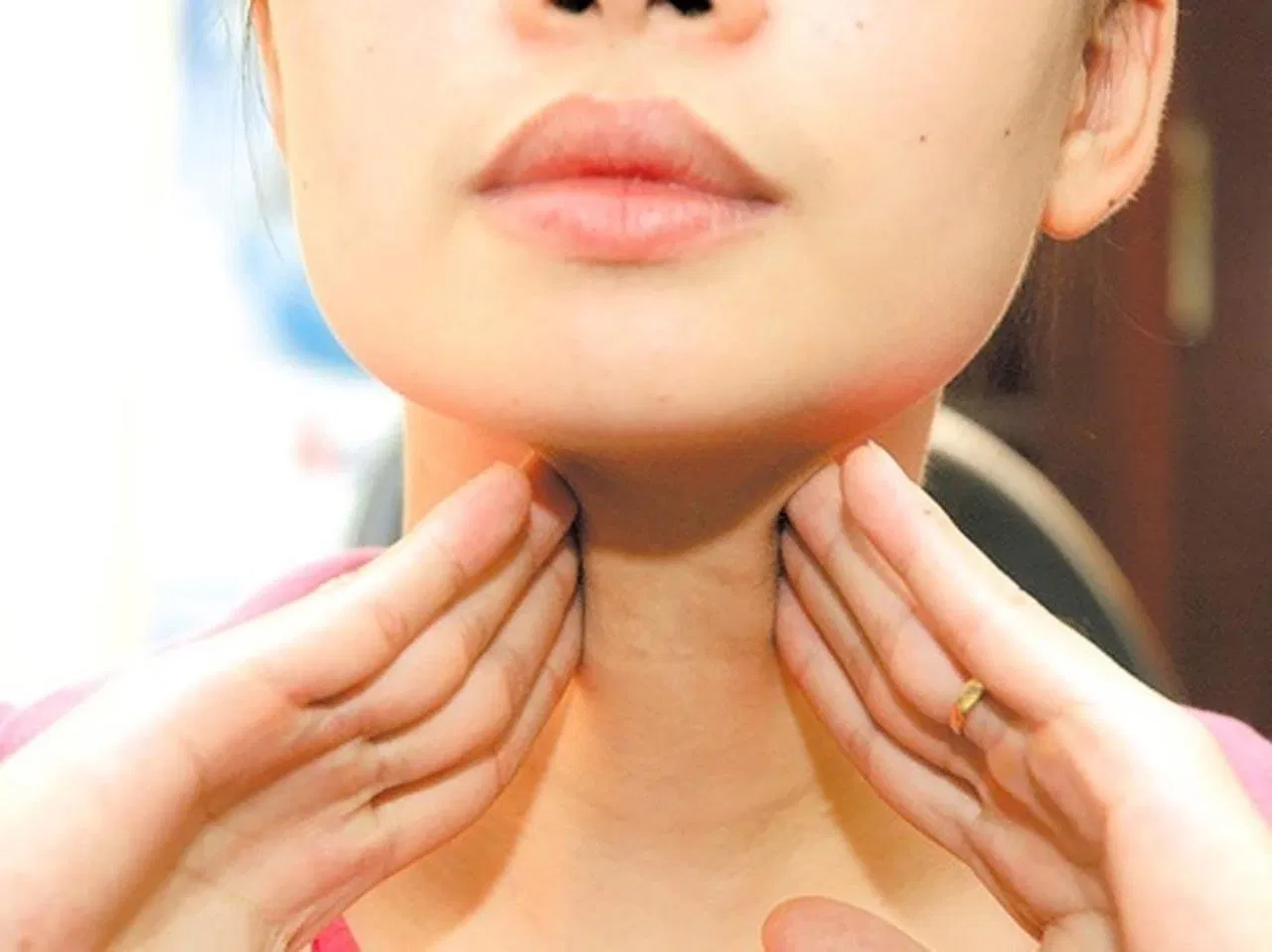 bệnh cường giáp