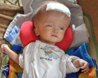 Não úng thủy