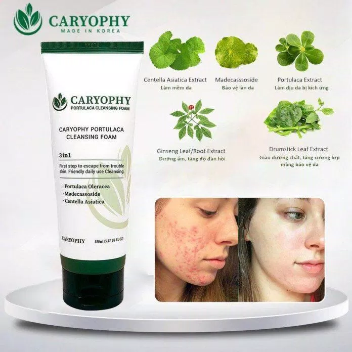 217 Review sữa rửa mặt trị mụn Caryophy Portulaca Cleansing Foam: Cho làn da khỏe đẹp, sạch mụn mới nhất 6 Danh sách các loại sữa rửa mặt có thành phần tự nhiên tốt nhất giúp trị mụn Caryophy Portulaca Cleansing Foam (nguồn: Internet)