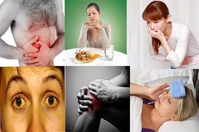 Triệu chứng viêm gan C Triệu chứng viêm gan C