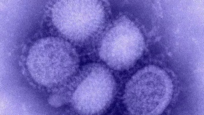 Hình dạng chủng cúm A H1N1 có nguồn gốc từ lợn.