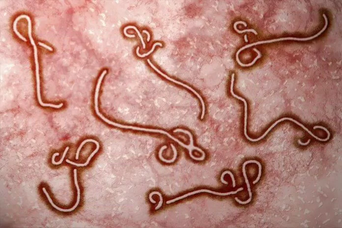 ebola virus