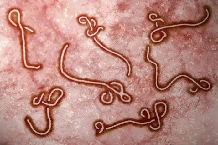 vi rút Ebola