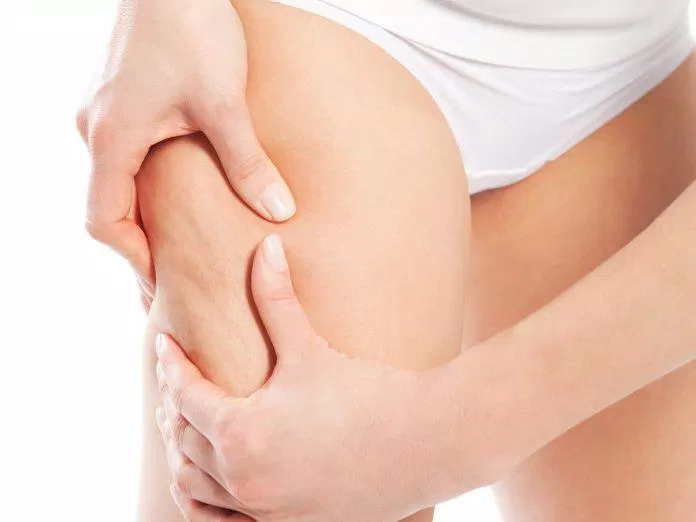 Giảm mỡ đùi thật sự rất dễ dàng nếu bạn biết tập luyện đúng cách (Nguồn ảnh: Internet)