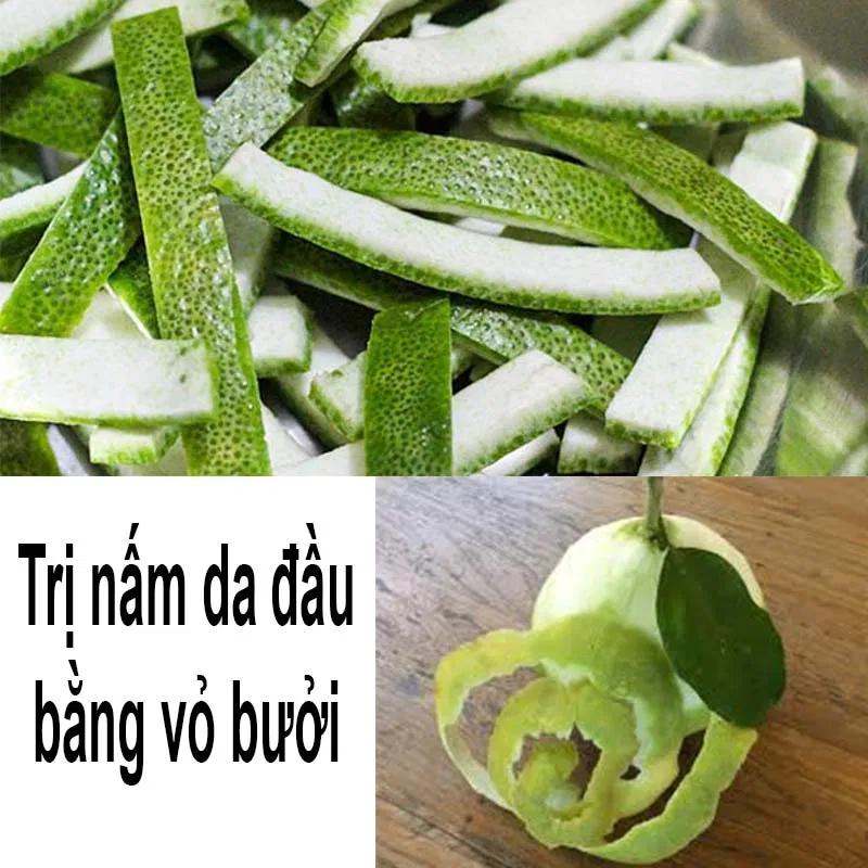 Cách trị nấm da đầu bằng vỏ bưởi (Nguồn: Internet)