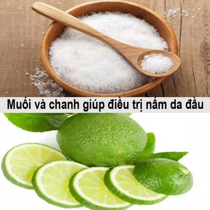Cách trị nấm da đầu bằng chanh và muối (Nguồn: Internet) Cách trị nấm da đầu bằng chanh và muối (Nguồn: Internet)