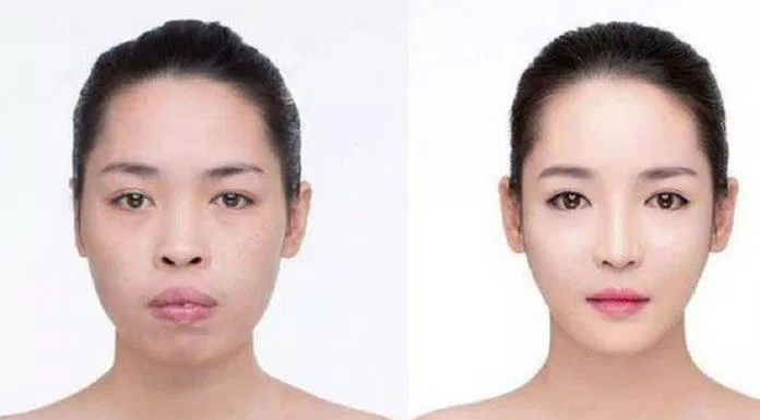 Thanh Quỳnh trước và sau phẫu thuật thay đổi diện mạo.
