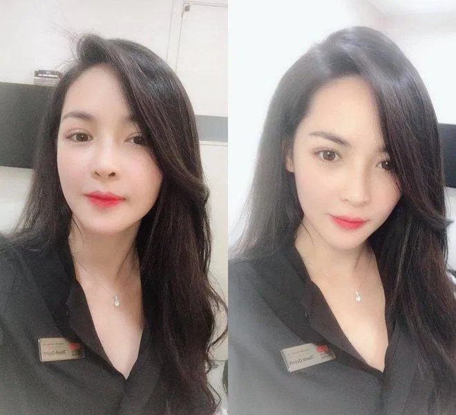 Thanh Quỳnh đang làm việc cho một bệnh viện thẩm mỹ với mong muốn tư vấn và giúp ích nhiều hơn cho các cô gái có chung hoàn cảnh và muốn dùng phẫu thuật thẩm mỹ để thay đổi.