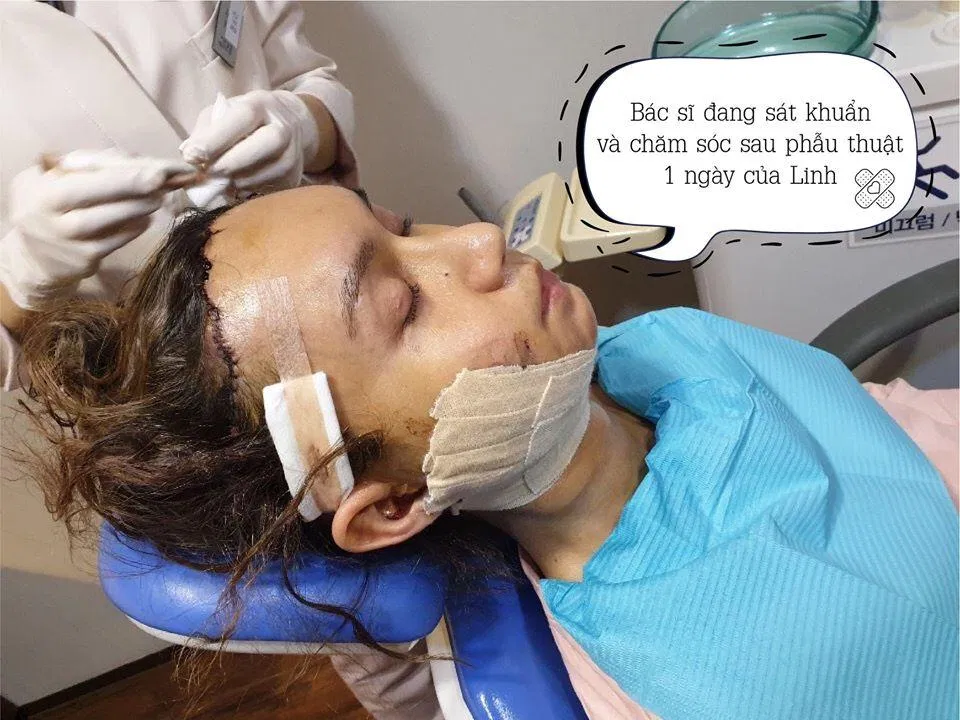 Lynk Lee chia sẻ cả quá trình làm sạch vết thương (Nguồn: Internet)