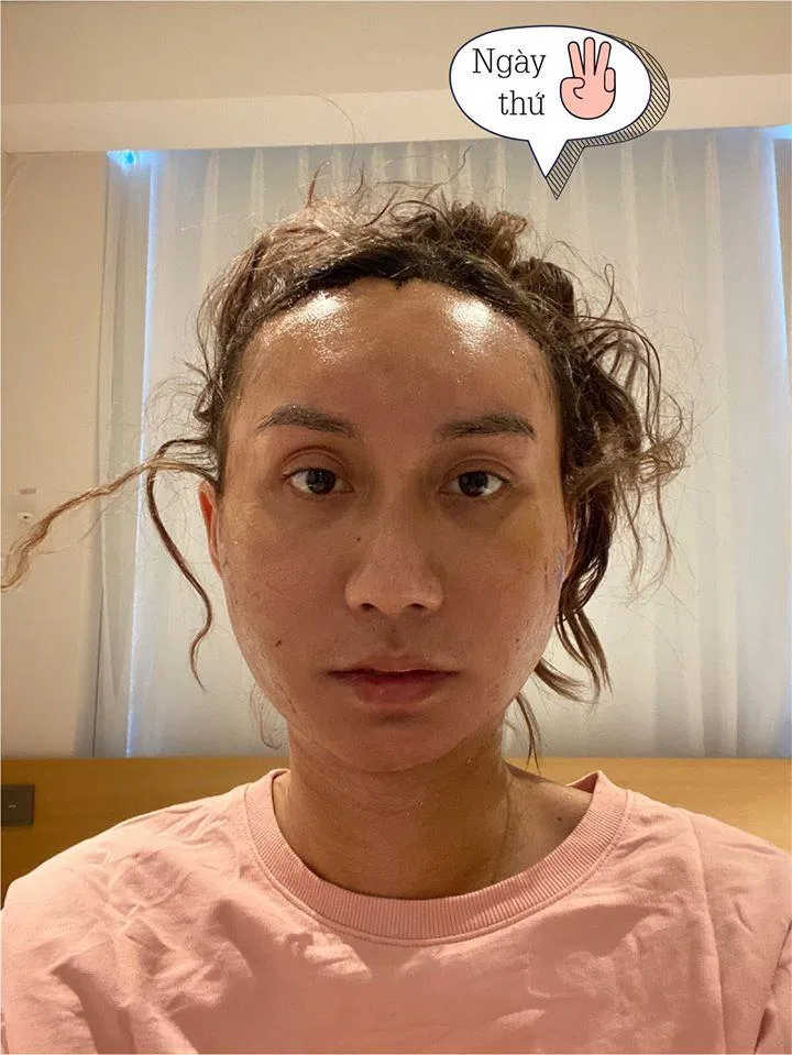 Những ngày ở trong viện mòn mỏi chờ đợi kết quả (Nguồn: Internet)