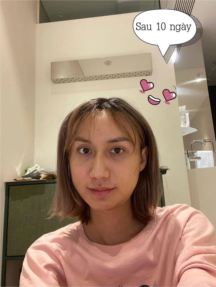 Khuôn mặt Lynk đã nữ tính hơn rồi này (Nguồn: Internet)