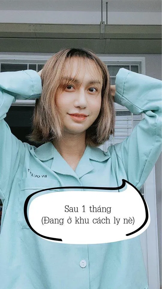 Sau 1 tháng phẫu thuật (Nguồn: Internet)