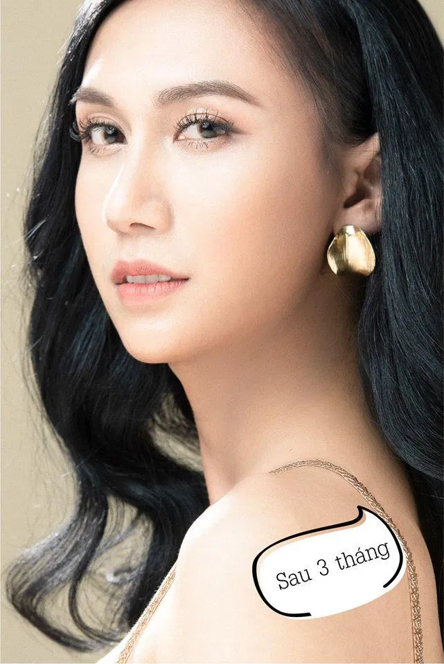 Nếu nhìn như này ai dám bảo đây là Lynk Lee nam tính ngày xưa nào? (Nguồn: Internet)