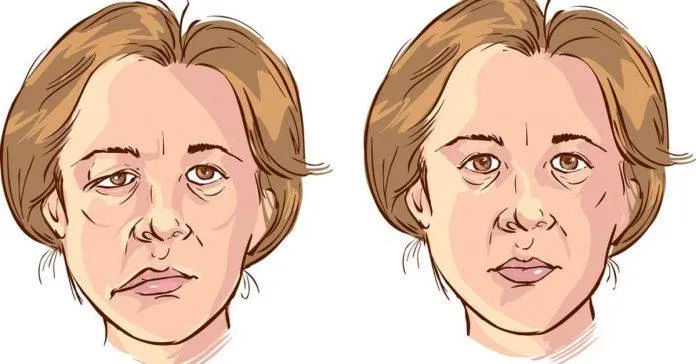 87 Để tóc ướt đi ngủ có hại không? mới nhất 7 Bạn có nguy cơ bị liệt cơ mặt khi ngủ tóc vẫn còn ướt (Nguồn: Internet)