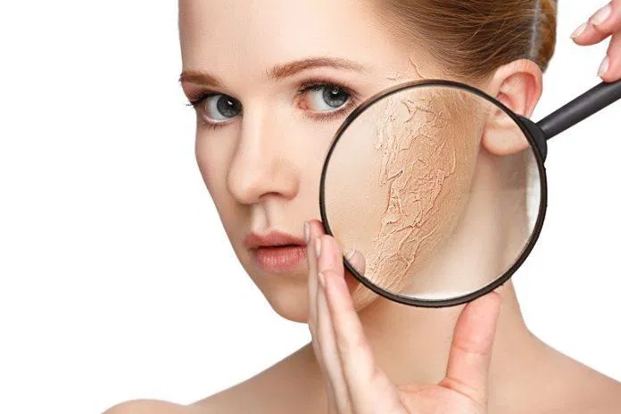87 Để tóc ướt đi ngủ có hại không? mới nhất 5 Làn da sẽ trở nên khô hơn khi ngủ tóc vẫn còn ướt (Nguồn: Internet)