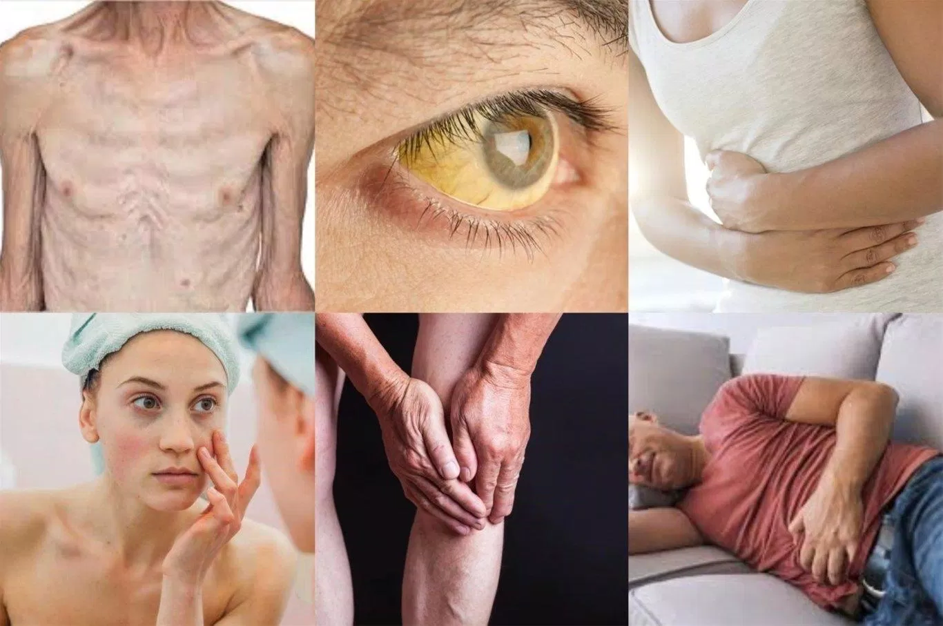 Những triệu chứng mà bệnh nhân viêm gan B có thể gặp phải (Nguồn: Internet).