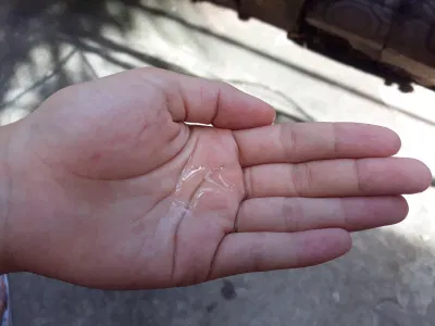 Tinh chất dạng lỏng, không màu, mùi hơi nồng nhưng không quá gắt, dễ dàng hấp thụ nhanh vào da khi xoa (ảnh: BlogAnChoi).