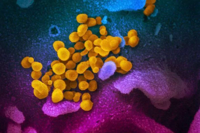 Ảnh kính hiển vi điện tử quét cho thấy virus Corona có màu vàng nổi bật trên nề tế bào hồng và xanh. (Nguồn: Internet)