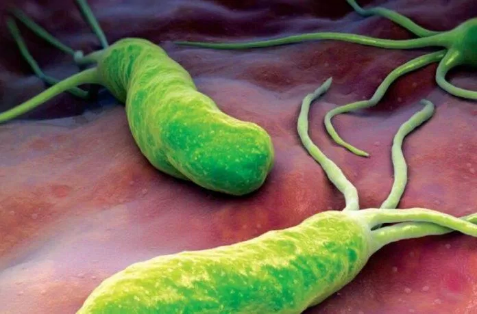 Hình ảnh vi khuẩn HP qua kính hiển vi (Nguồn: Internet).