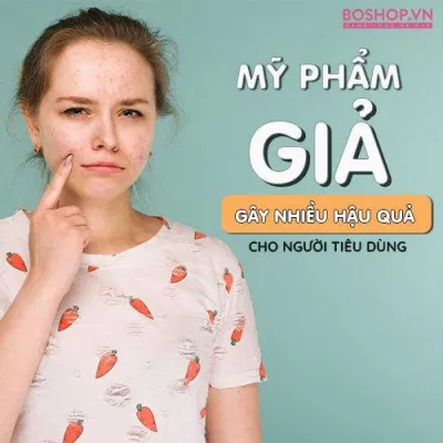 Mỹ phẩm giả, kém chất lượng gây nhiều tác hại cho làn da và sức khỏe. (Ảnh: Internet)