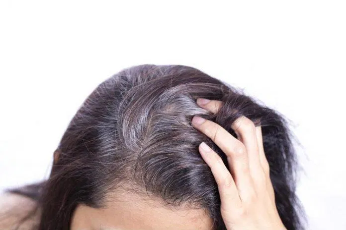 Tóc bạc không chỉ là nỗi lo của người lớn tuổi mà cả người trẻ