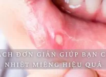 5 dấu hiệu vô sinh cần biết để điều trị kịp thời