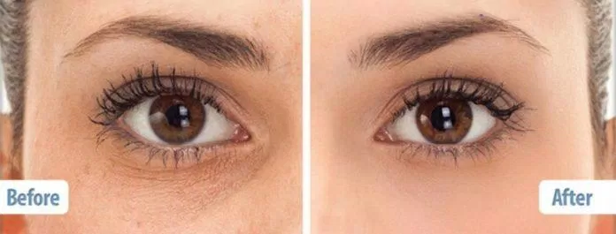 Review kem mắt nọc rắn Balance Active Formula Snake Venom Anti-Ageing Eye Cream: giải pháp tối ưu cho vùng da mắt Balance Active Formula Balance Active Formula Snake Venom Anti Ageing Eye Cream beauty blogger Cetearyl Alcohol chống lão hoá công dụng dưỡng ẩm EyePro 3X giảm nếp nhăn glycerin Hydrolyzed rice protein kem mắt kem mắt Balance Active Formula Snake Venom Anti Ageing Eye Cream kem mắt nọc rắn Balance Active Formula Snake Venom Anti Ageing Eye Cream kem mắt tốt khám phá làm đẹp làm đẹp da mờ thâm mỹ phẩm review mỹ phẩm sản phẩm Syn Ake thiết kế thương hiệu Trinh Pham