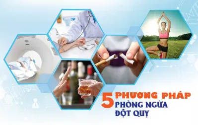 Sống tích cực, tập thể dục thường xuyên để phòng tránh đột quỵ (Ảnh: Internet). Sống tích cực, tập thể dục thường xuyên để phòng tránh đột quỵ (Ảnh: Internet).