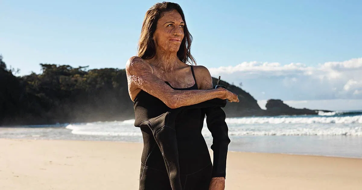 Turia Pitt - đại sứ thương hiệu Avène dòng sản phẩm kem chống nắng (Ảnh Internet)